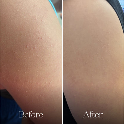 Everist - Exfoliating Body Wash Concentrate