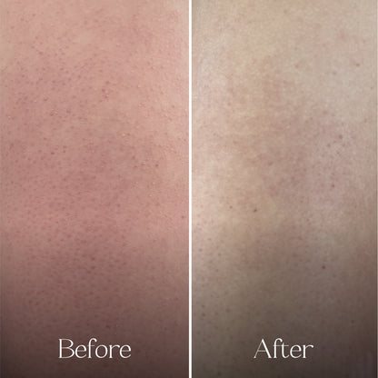 Everist - Exfoliating Body Wash Concentrate